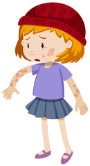 Little girl with ringworm on her body