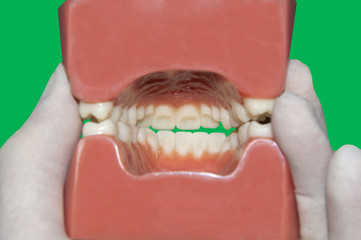 View of interior mouth: Green Screen/ Chroma key