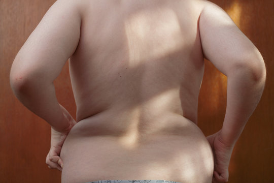 Boy 12 years metabolic disease. obese child