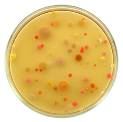 Different color, size and type colonies of bacteria from public premises air on a petri dish (agar...