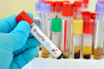 Blood sample positive with Brucella bacteria infected test
