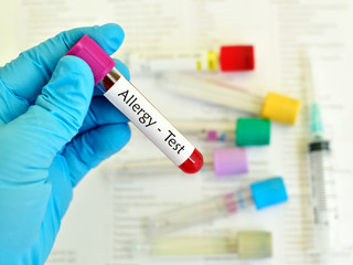 Blood sample for allergy testing