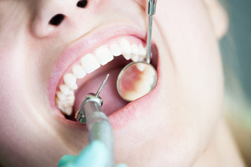Dental drilling procedure on beautiful teeth