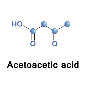 Acetoacetic acid structure.