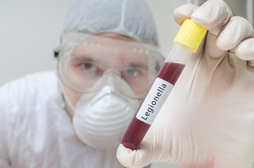 Researcher in laboratory holds test tube with Legionella blood sample.