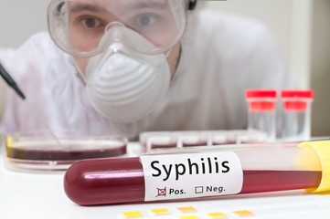 Test tube with blood for Syphilis test in front of researcher.