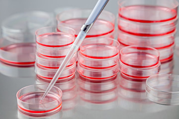 Tissue culture petri dishes