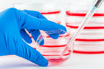 Removing samples from a cell culture dish.