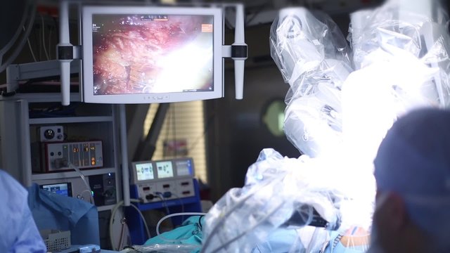 Robotic Surgery. Medical robot. Medical operation involving robot - Stock Video