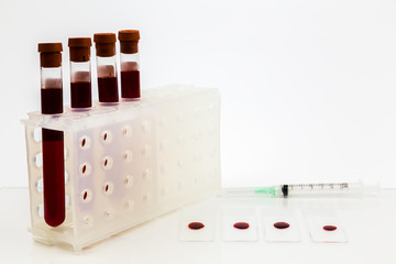 Blood samples for Testing.