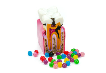 Concept of over-consumption, excessive candies, sugar consumption and dental diseases, caries,...