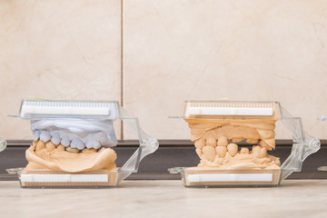 Dental casting gypsum models plaster