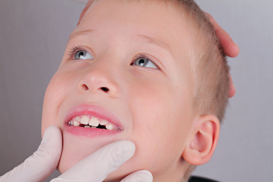 Kid in dentist chair. Child dental care, orthodontics, putting dental braces