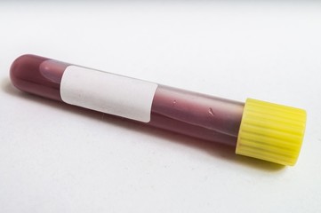 Blood in test tube with empty label for custom text.