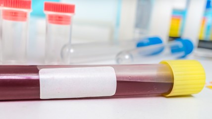 Test tube with blood and empty label for text.