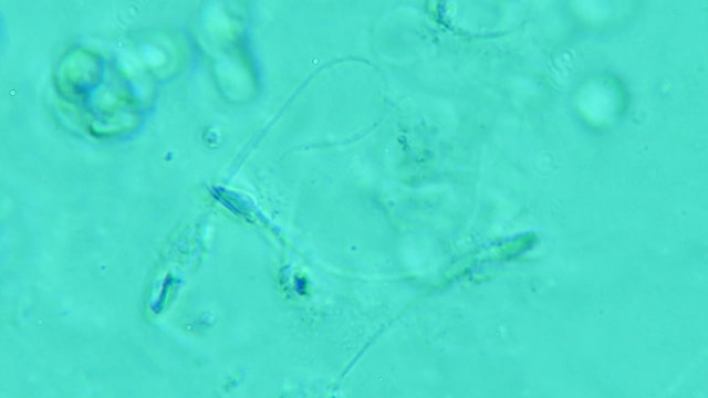 Human Sperm Dead Specimens