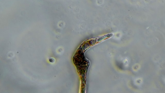 Nematode Worm Stretches Body While Swimming Under Microscope 400x