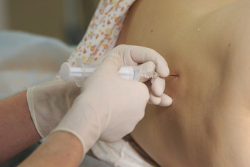 Spinal Anesthesia close-up