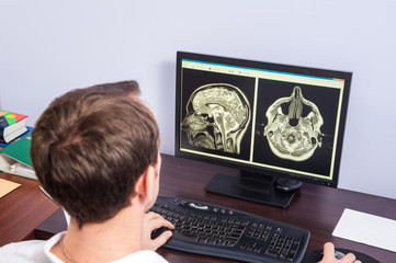 computer tomography / The doctor during the visual inspection the results of the tomography in...