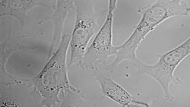 Movement, division and death of HeLa cervical cancer cells under microscope
