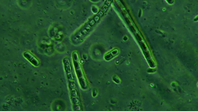Moss and Bacteria Colony Seen Feeding And Swimming with Protozoa