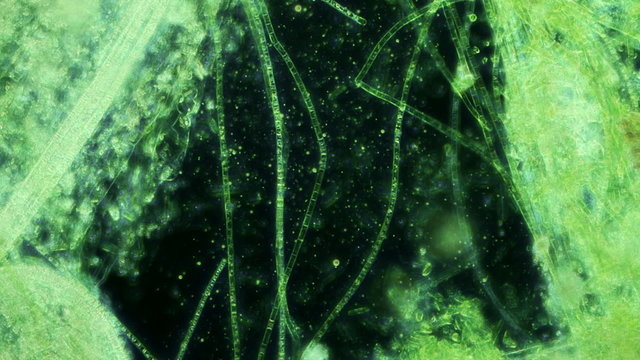 Moss and Bacteria Seen In Dark Field Microscope 400x