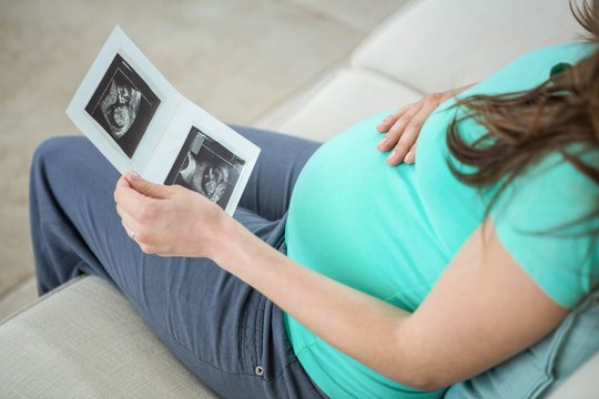 Pregnant Woman Looking At Ultrasound Scans