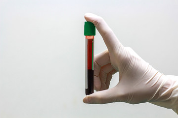 Hand with latex glove holding blood sample on white background