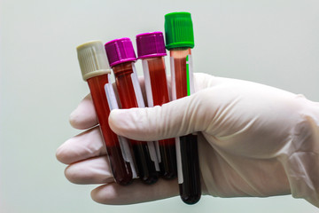 Hand with latex glove holding blood sample on white background