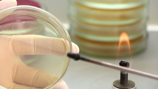 Microbiologist opens perti dish and inoculate agar surface by strokes of bacteriological loop. Lockdown. Close-up