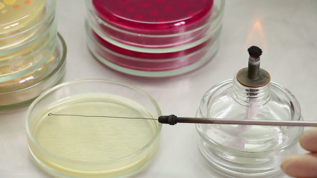 Microbiologist opens perti dish, inoculates agar surface by strokes of bacteriological loop and removes glassware. Lockdown. Point of view. Close-up.