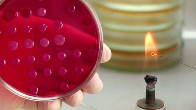 Microbiologist heats the loop, opens perti dish and touches  bacterial colony on red agar (Endo) by bacteriologist's tool. Point of view. Close-up.