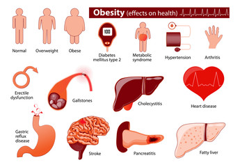 Obesity and overweight infographic