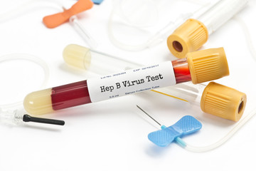 Hepatitis Test