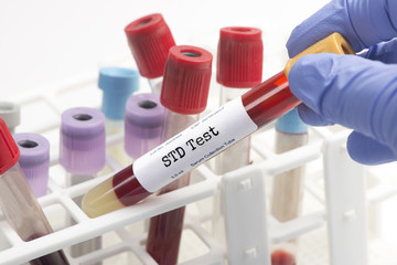 STD Testing - obrazy, fototapety, plakaty