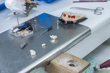 Dental crown or bridge with tooth lithium disilicate.