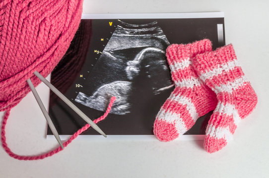 Ultrasound picture and knitted shoes. Pregnancy concept.