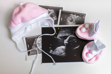 Fototapeta na wymiar Many ultrasound pictures and clothes for baby girl. Expecting in pregnancy concept.