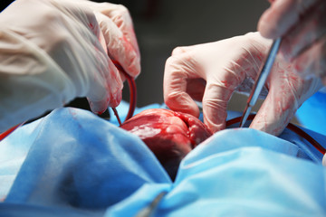 Doctor doing heart operation