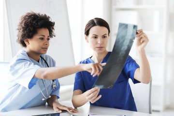 female doctors with x-ray image at hospital