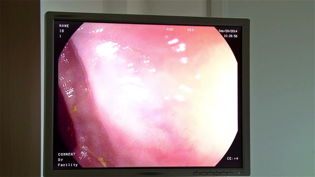 Endoscopy diagnose monitor