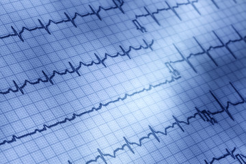 Naklejka premium 医療イメージ/心電図