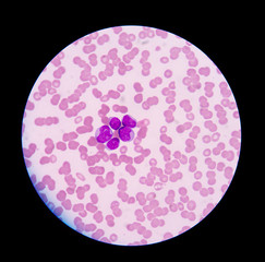  blood smear is often used as a follow-up test to abnormal resul