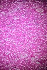Human kidney, cortical zone under microscope