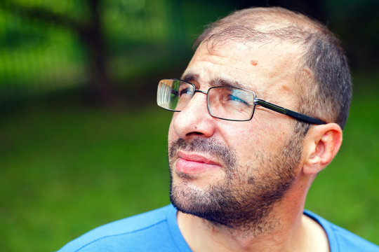 Portrait Of Young Man With Bad Eyesight And Hair Loss.