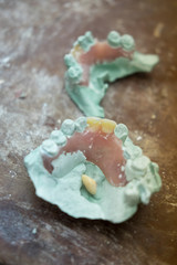 set of dentures. False teeth