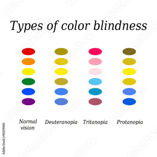 Types Of Color Blindness Eye Color Perception Vector Coloring Wallpapers Download Free Images Wallpaper [coloring436.blogspot.com]