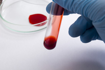 Tubes of blood as the blood test