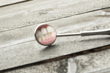 Specchietto da dentista che riflette una dentatura su sfondo legno chiaro