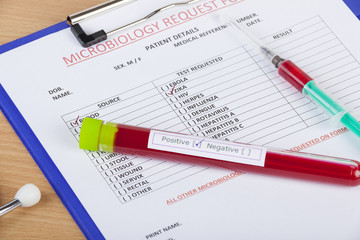 Microbiological blood test results show positive for Zika virus